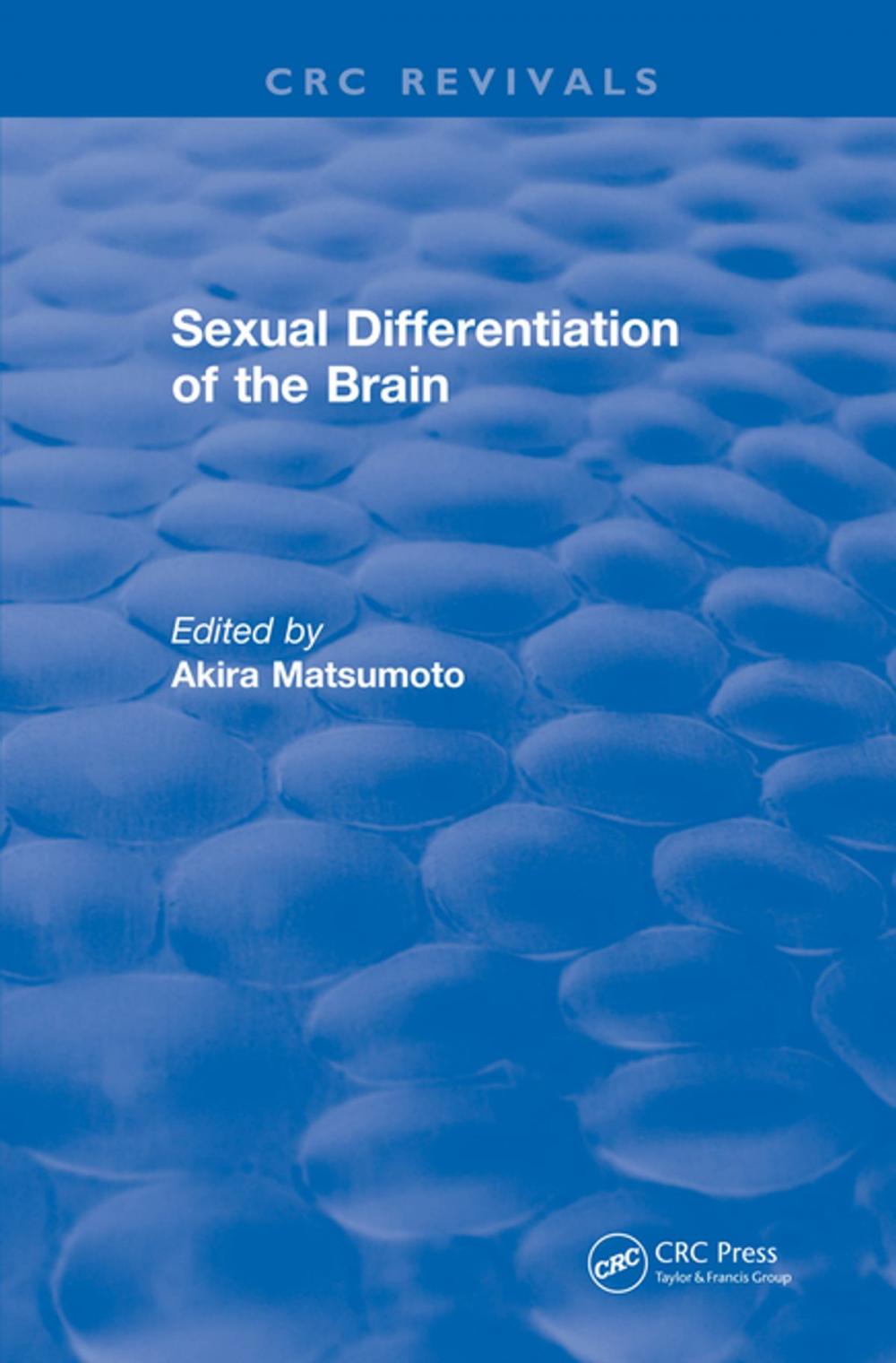 Big bigCover of Sexual Differentiation of the Brain (2000)