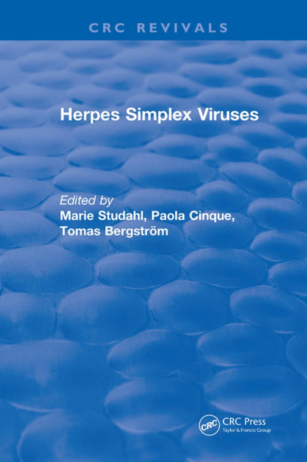 Big bigCover of Herpes Simplex Viruses