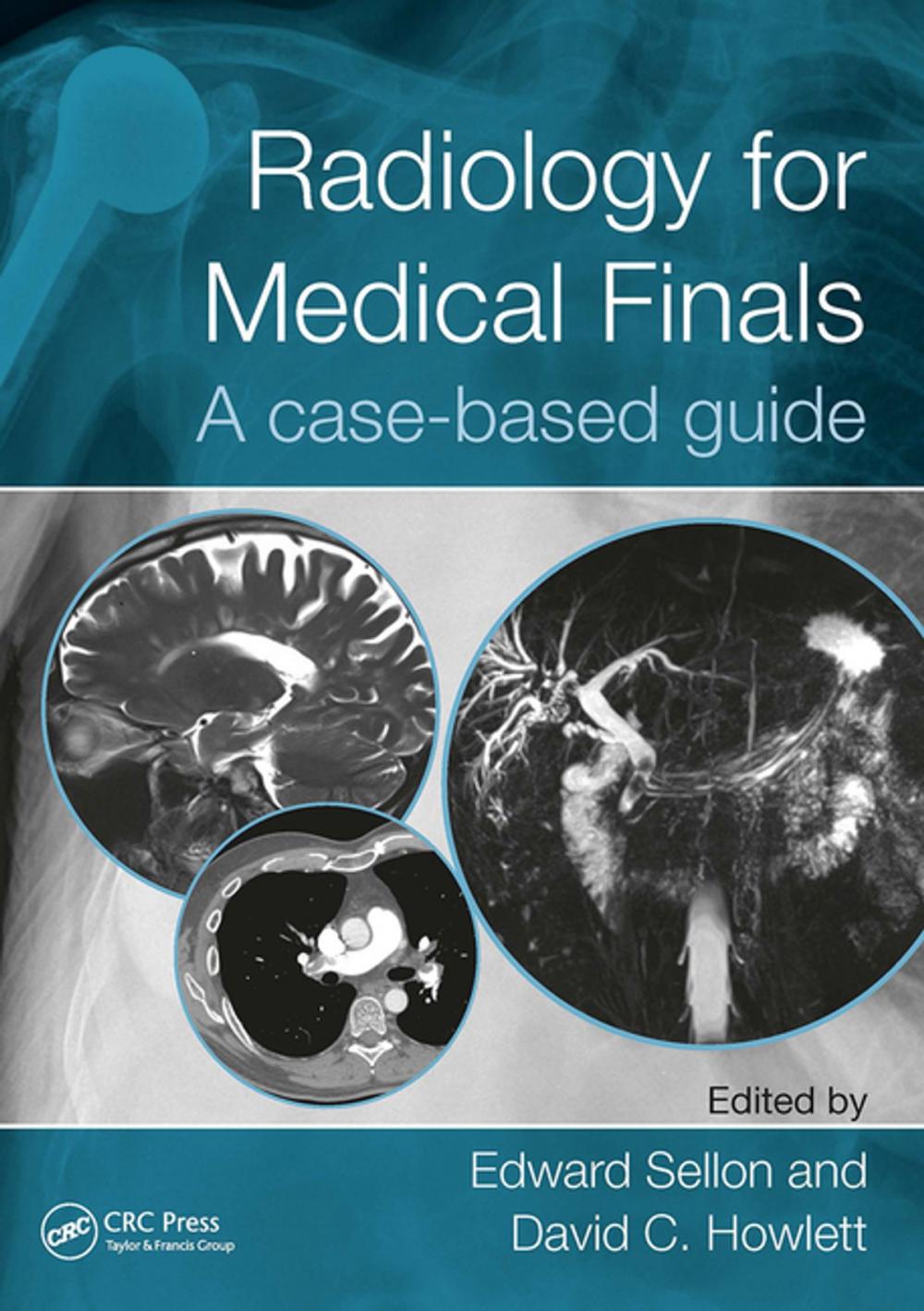 Big bigCover of Radiology for Medical Finals