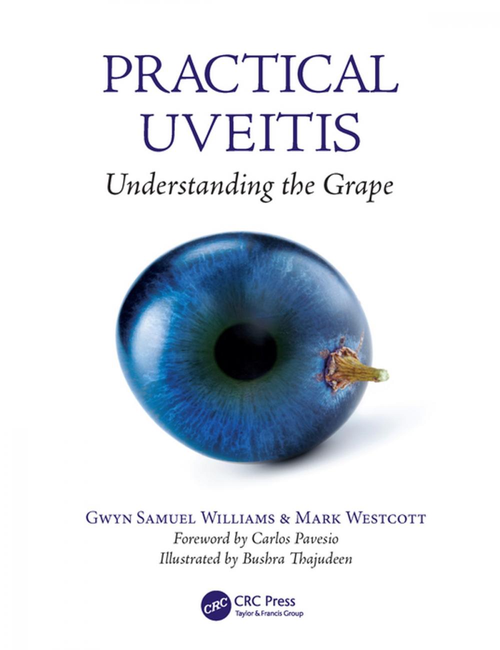 Big bigCover of Practical Uveitis