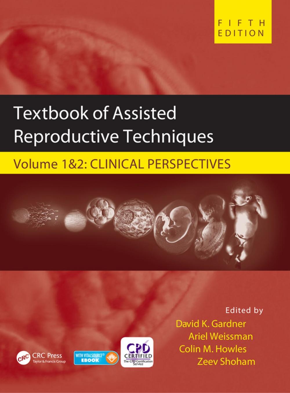 Big bigCover of Textbook of Assisted Reproductive Techniques