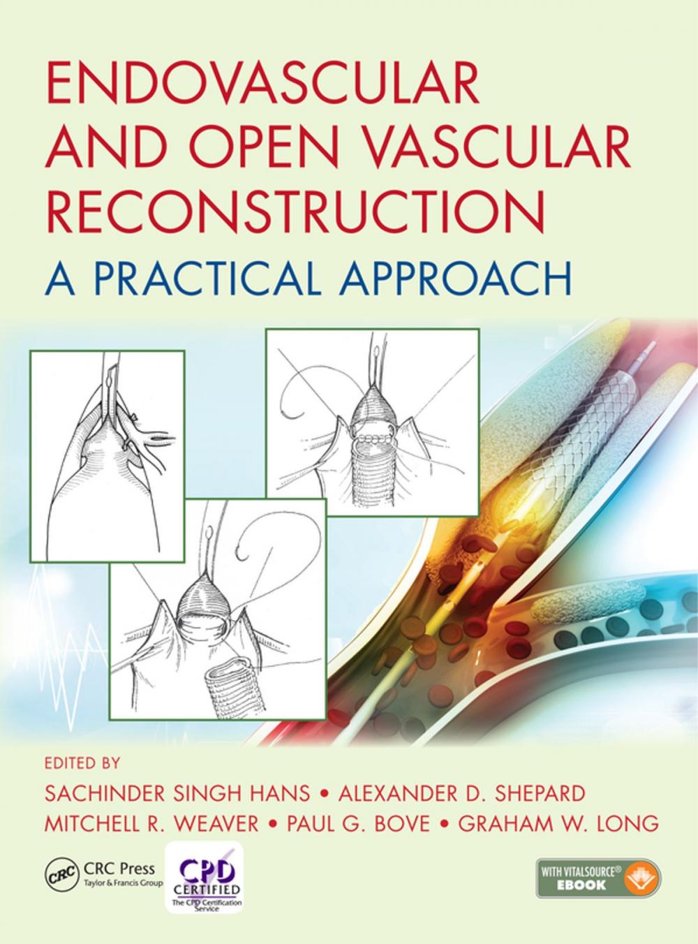 Big bigCover of Endovascular and Open Vascular Reconstruction