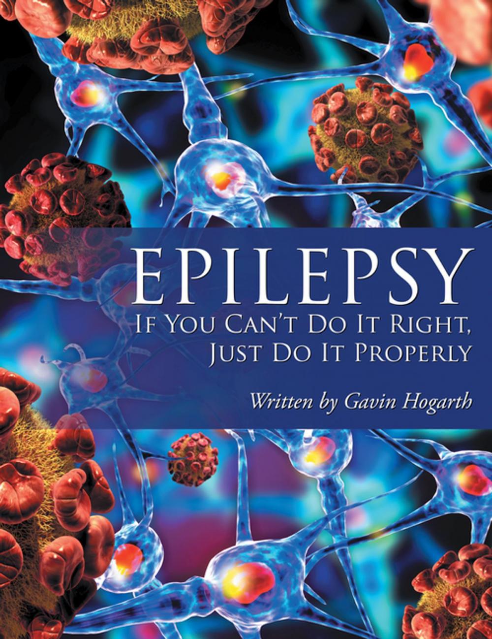 Big bigCover of Epilepsy