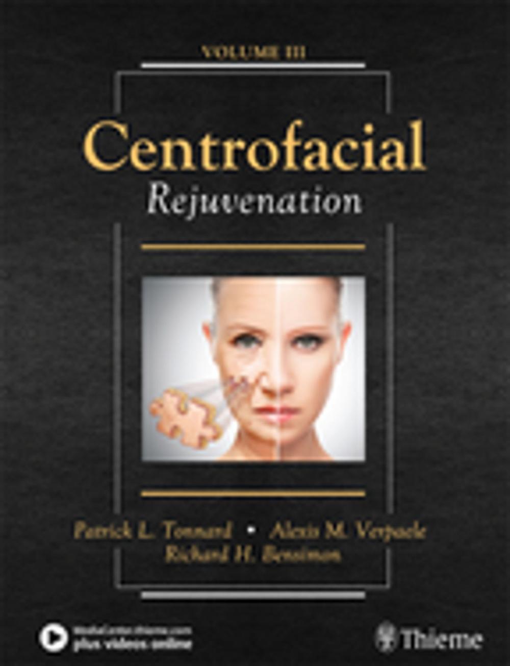 Big bigCover of Centrofacial Rejuvenation