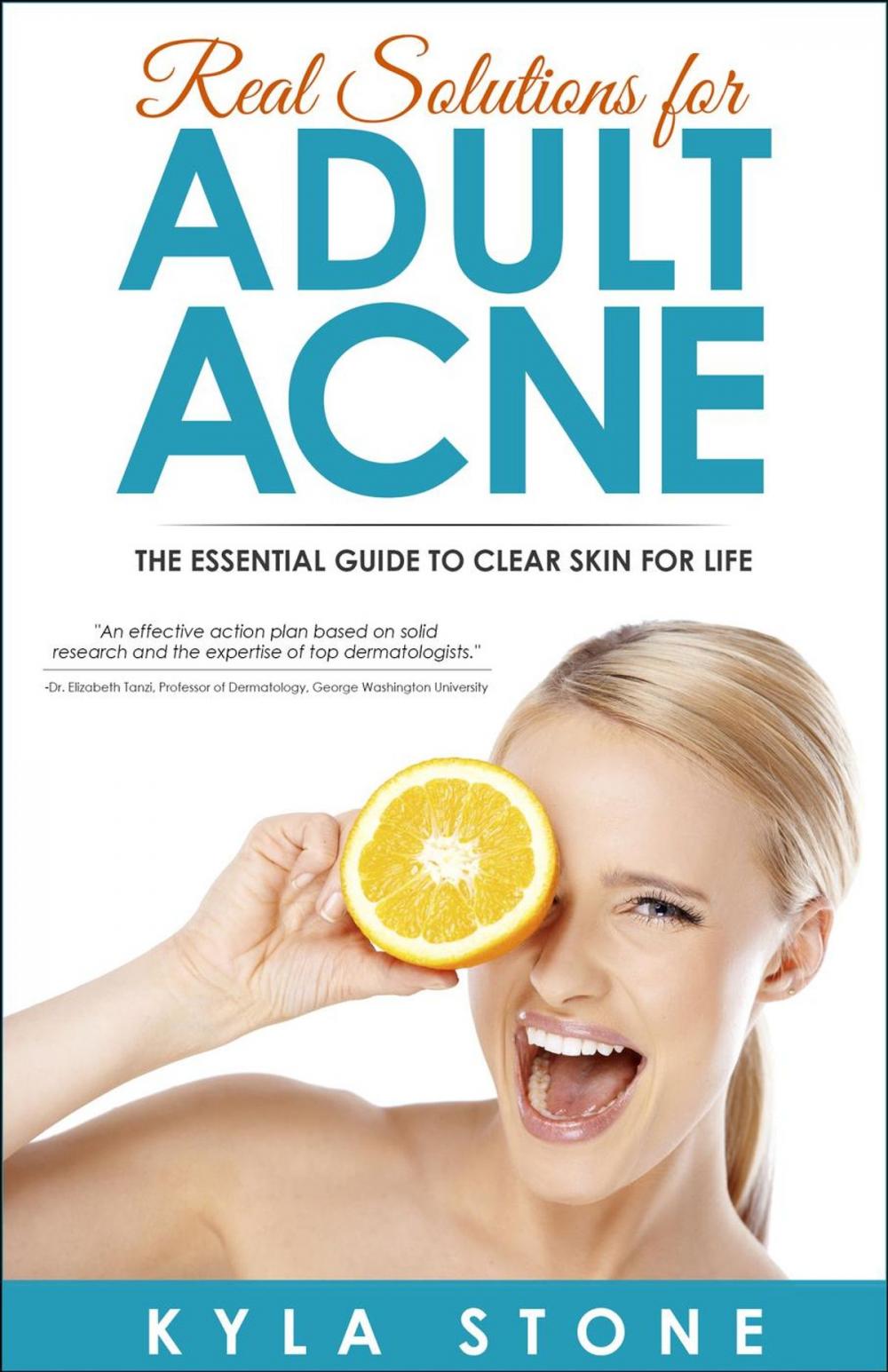 Big bigCover of Real Solutions for Adult Acne