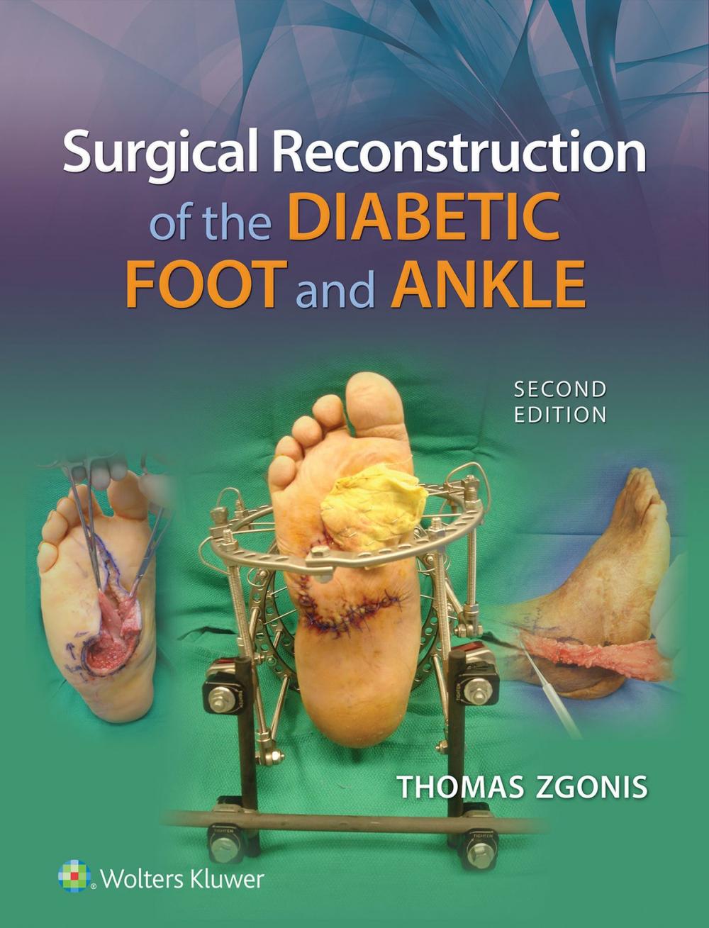 Big bigCover of Surgical Reconstruction of the Diabetic Foot and Ankle