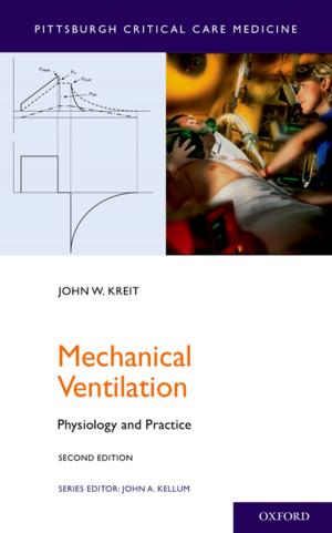 Cover of the book Mechanical Ventilation by Joyce F. Benenson