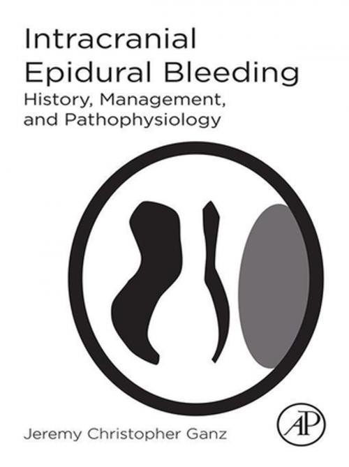 Cover of the book Intracranial Epidural Bleeding by Jeremy Christopher Ganz, Elsevier Science