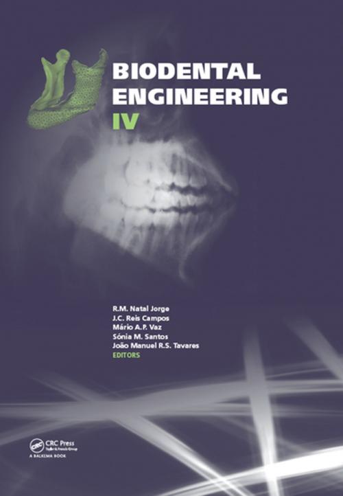 Cover of the book Biodental Engineering IV by , CRC Press