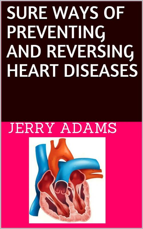 Cover of the book Sure Ways of Preventing and Reversing Heart Diseases by JERRY ADAMS, JERRY ADAMS