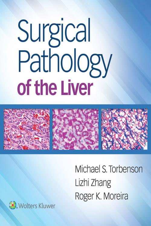 Cover of the book Surgical Pathology of the Liver by Michael Torbenson, Roger Moreira, Lizhi Zhang, Wolters Kluwer Health