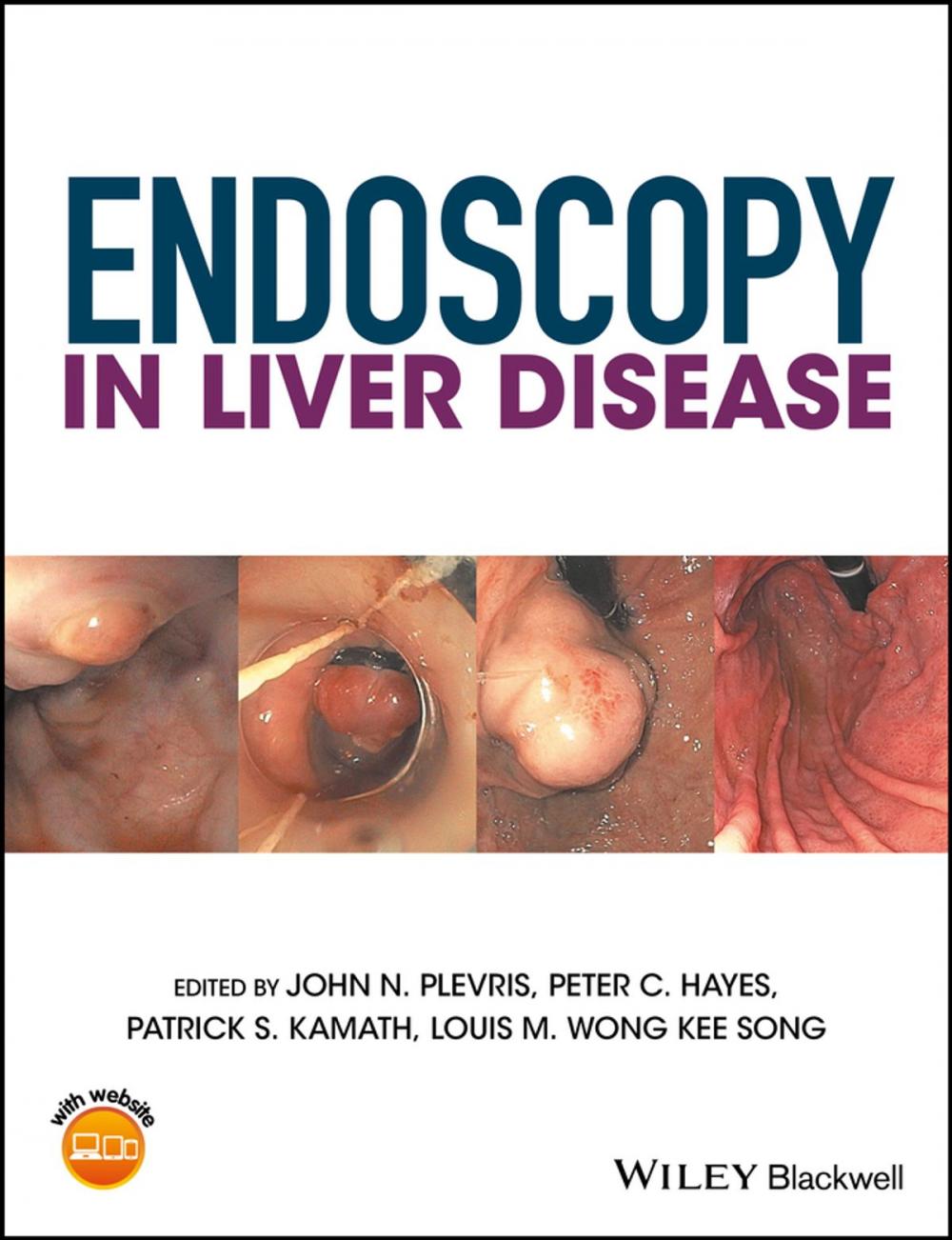 Big bigCover of Endoscopy in Liver Disease