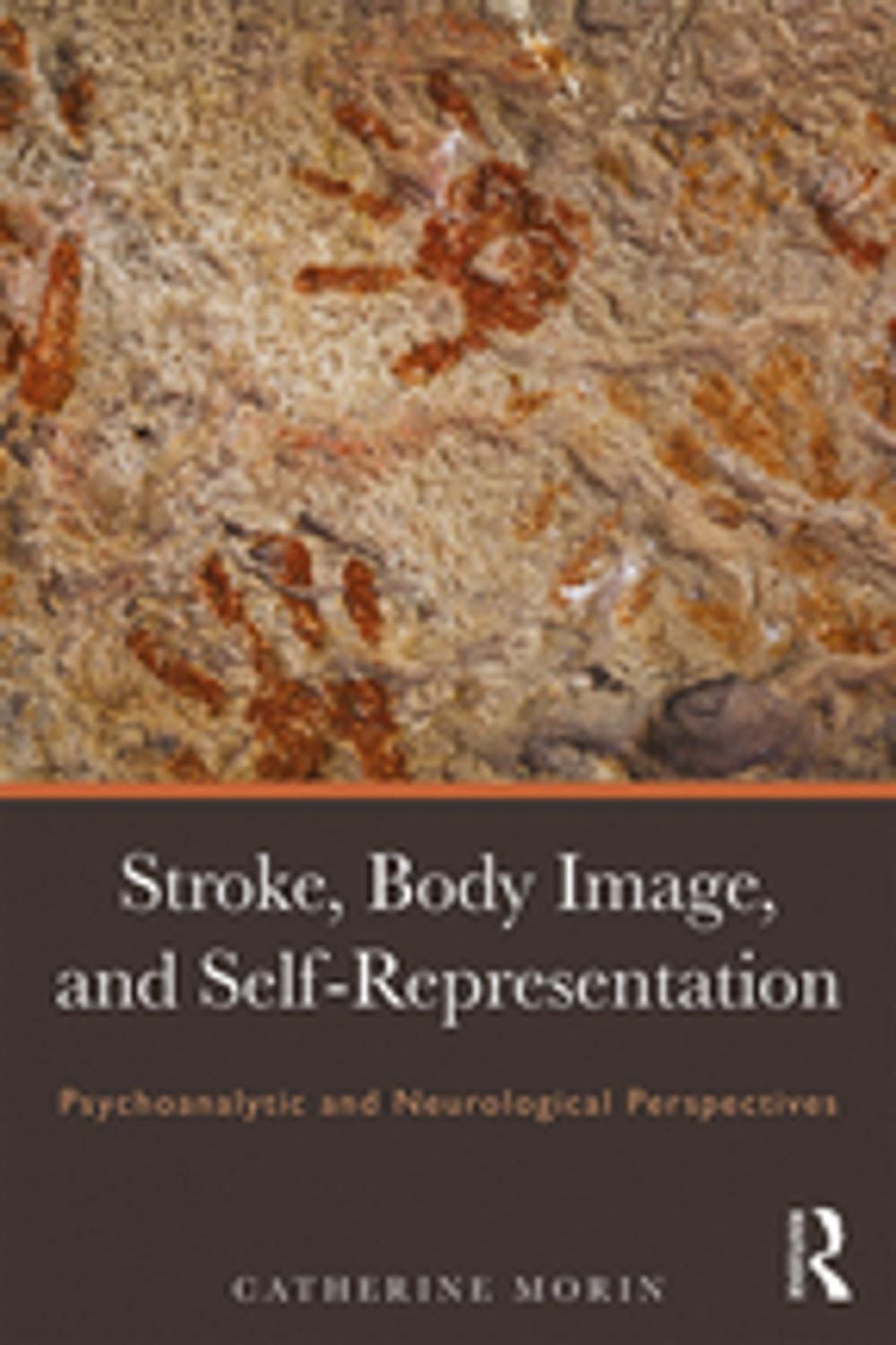 Big bigCover of Stroke, Body Image, and Self Representation