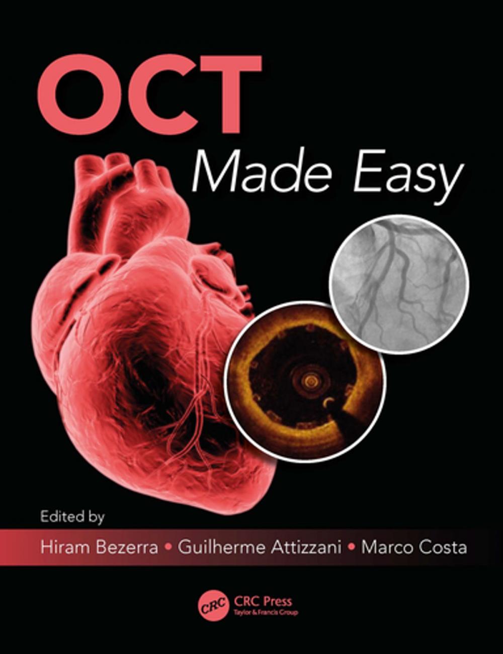 Big bigCover of OCT Made Easy