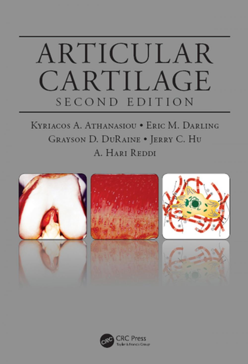 Big bigCover of Articular Cartilage