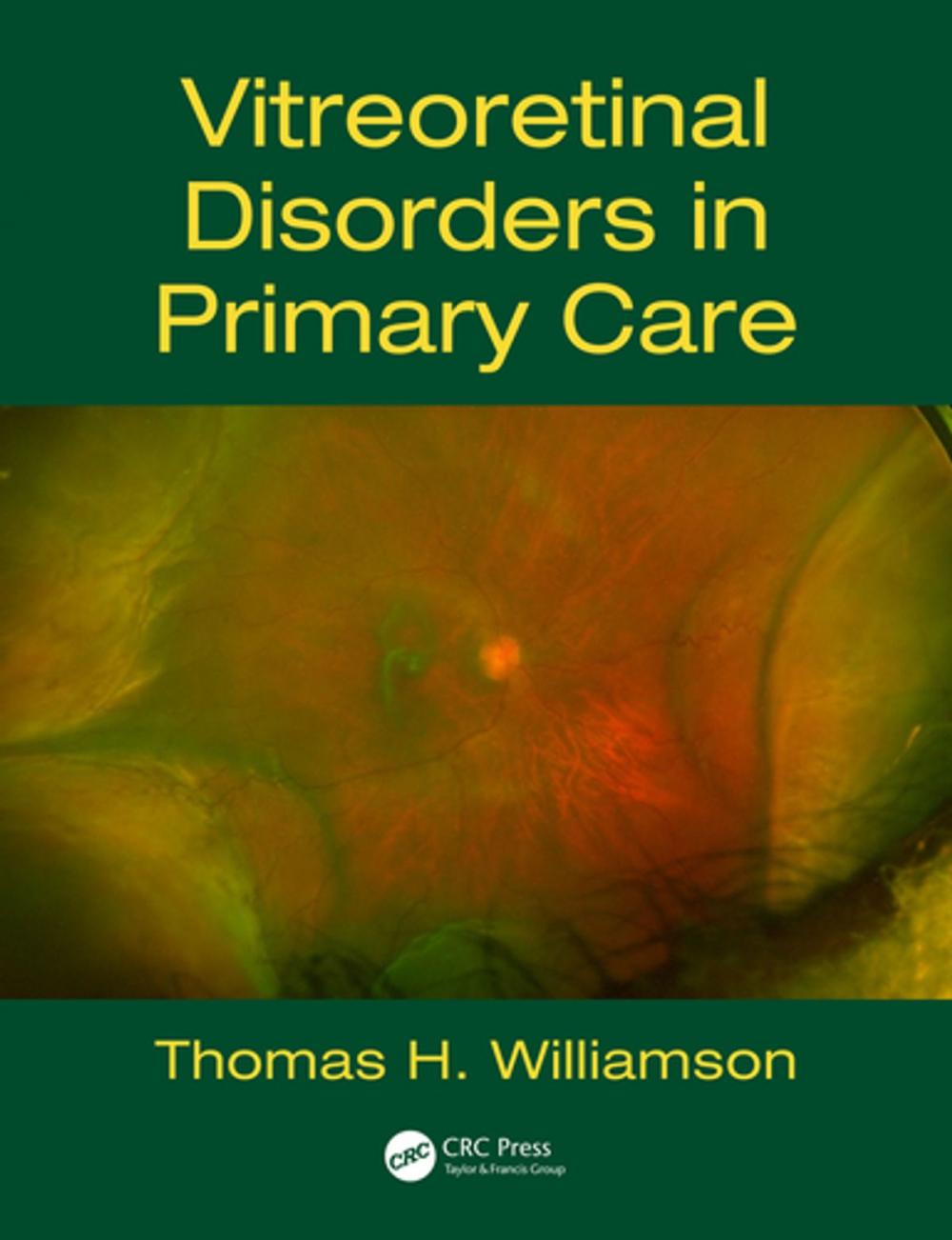 Big bigCover of Vitreoretinal Disorders in Primary Care