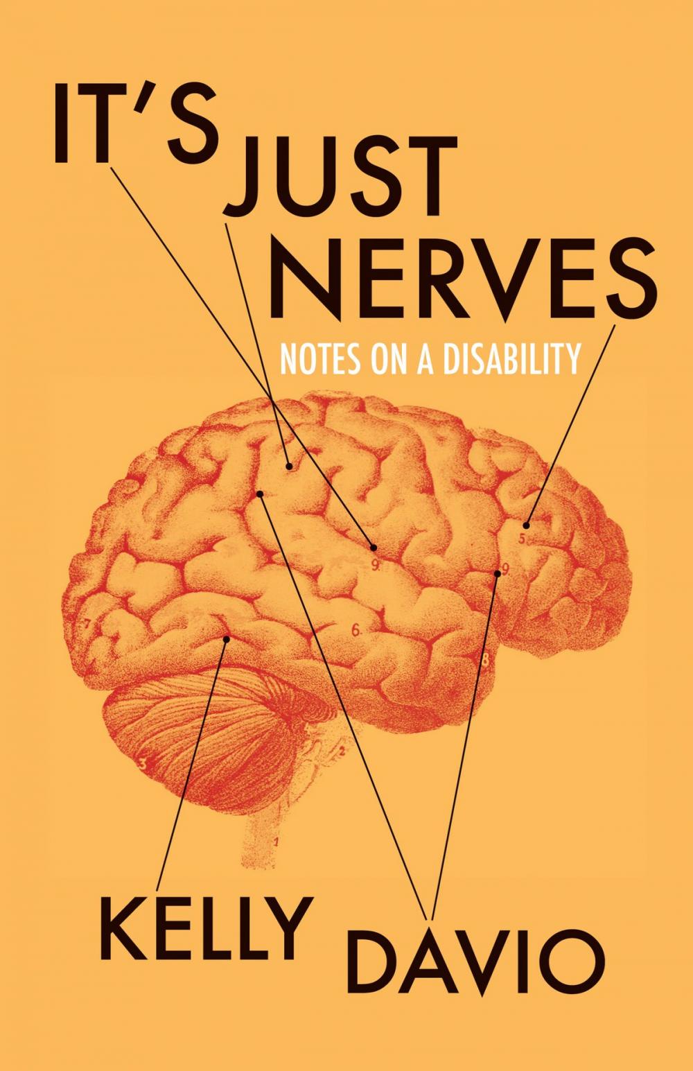 Big bigCover of It's Just Nerves: Notes on a Disability