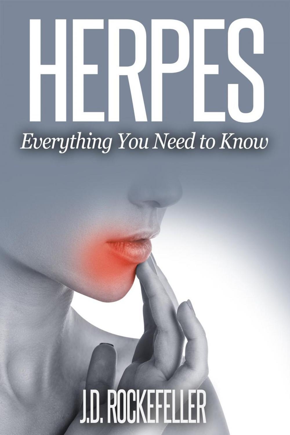 Big bigCover of Herpes: Everything You Need To Know