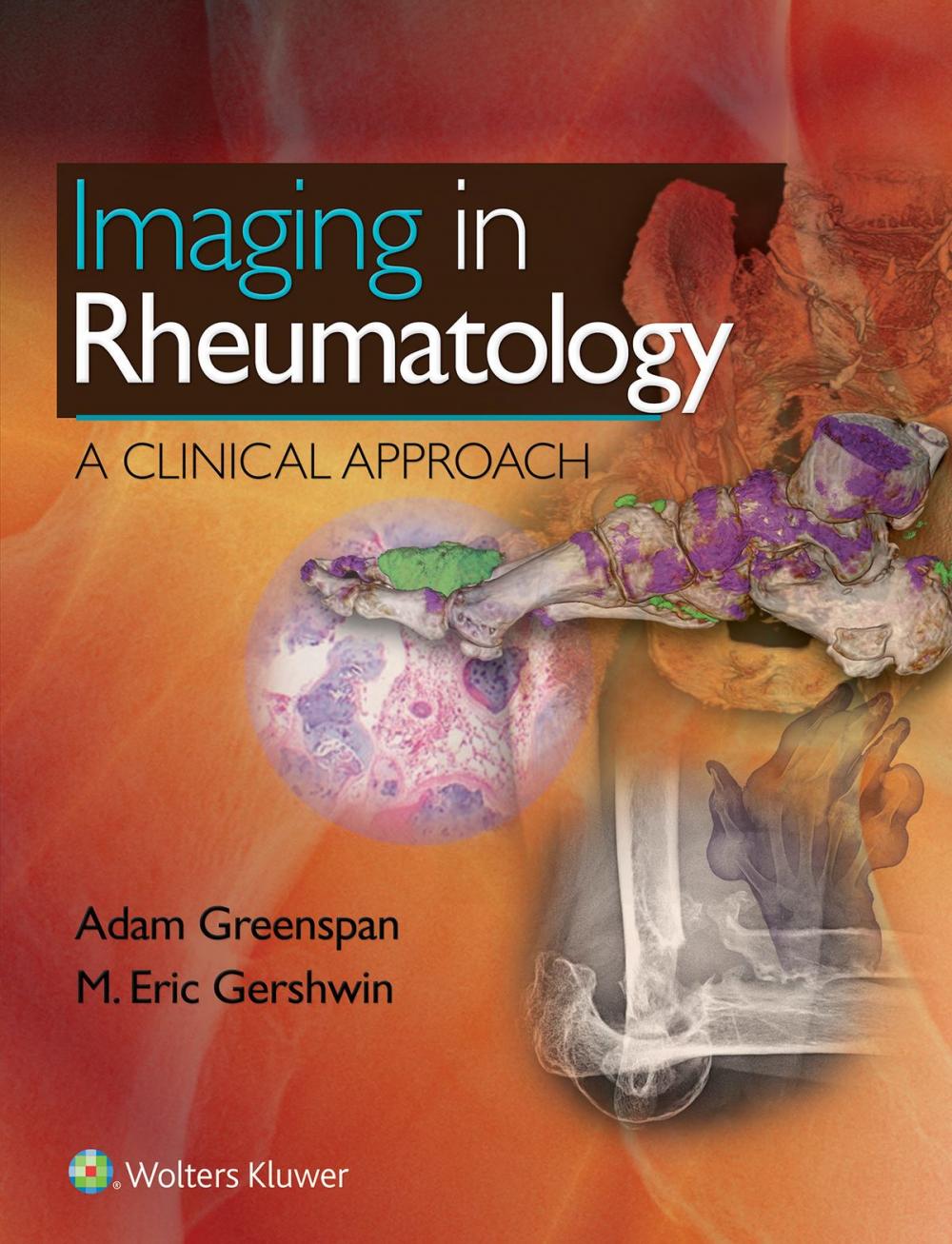 Big bigCover of Imaging in Rheumatology