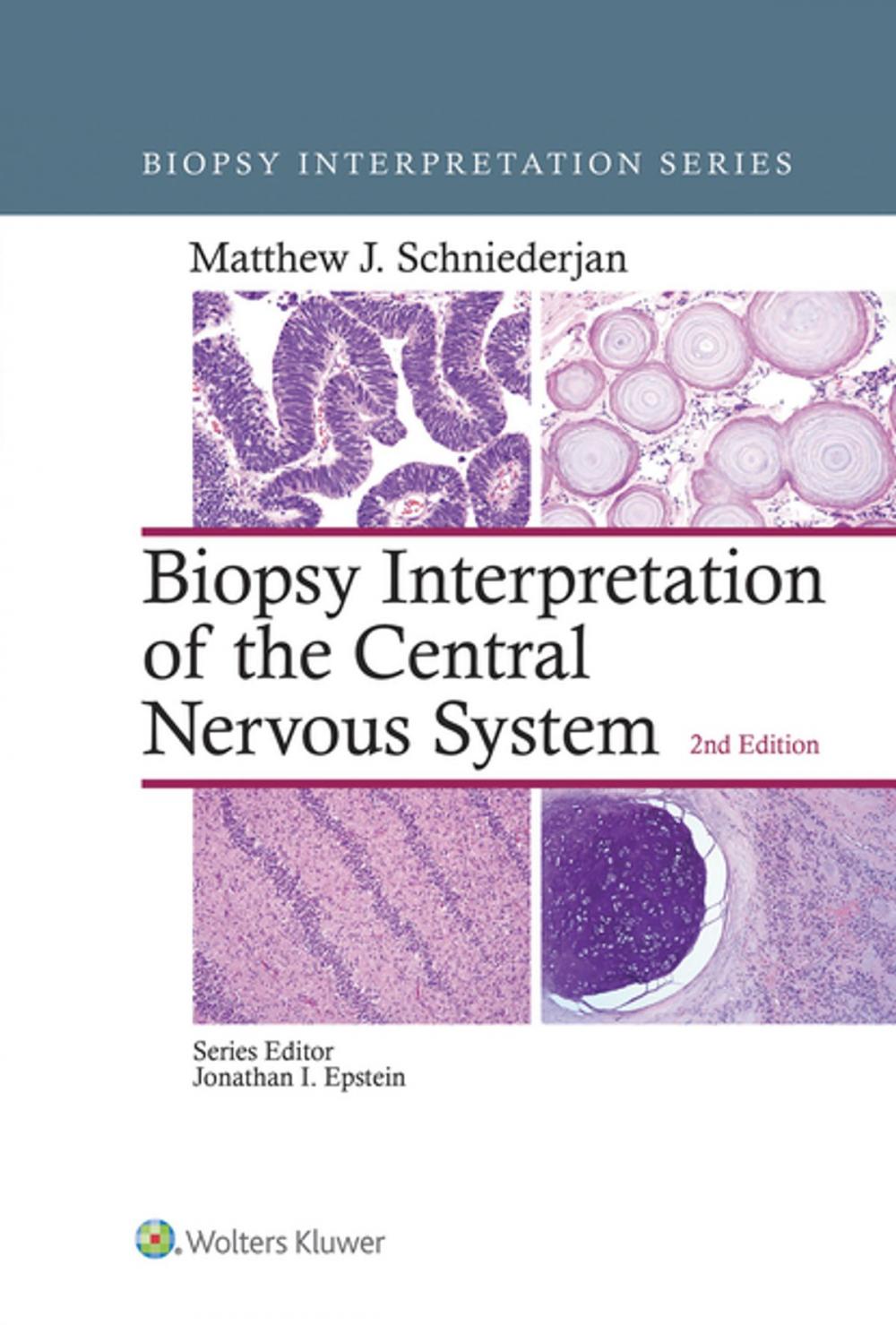 Big bigCover of Biopsy Interpretation of the Central Nervous System