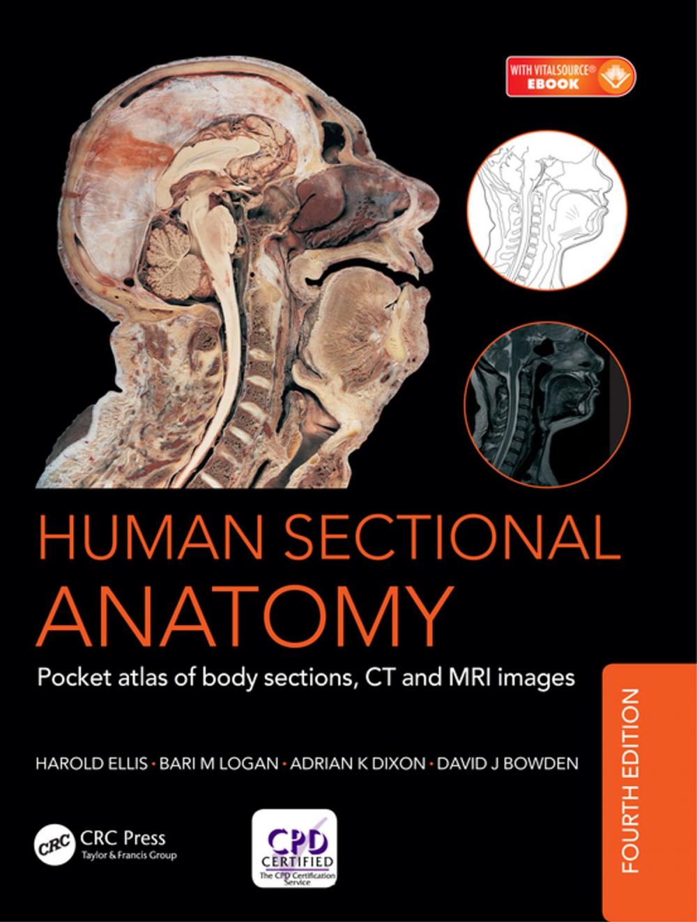 Big bigCover of Human Sectional Anatomy