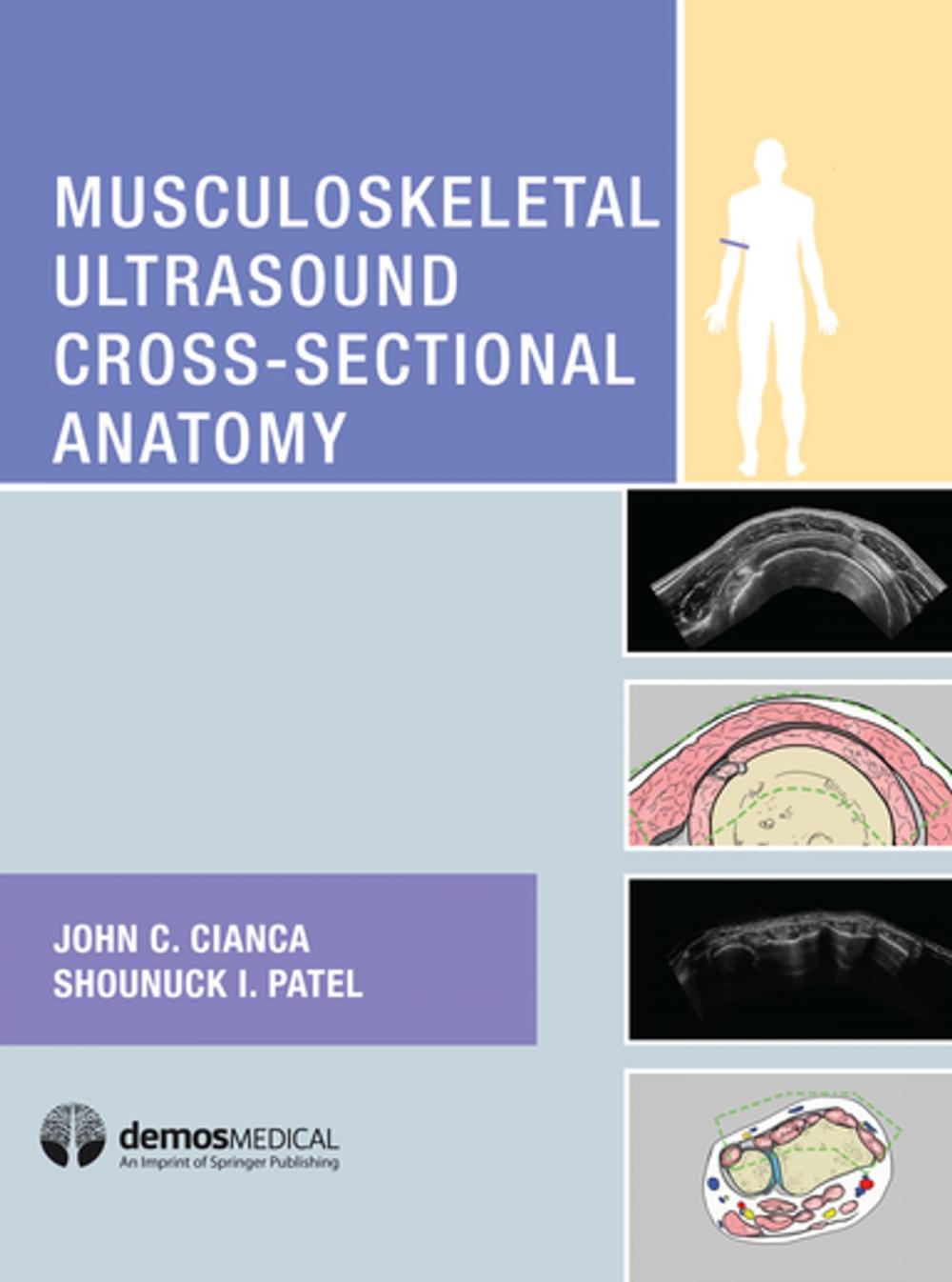 Big bigCover of Musculoskeletal Ultrasound Cross-Sectional Anatomy