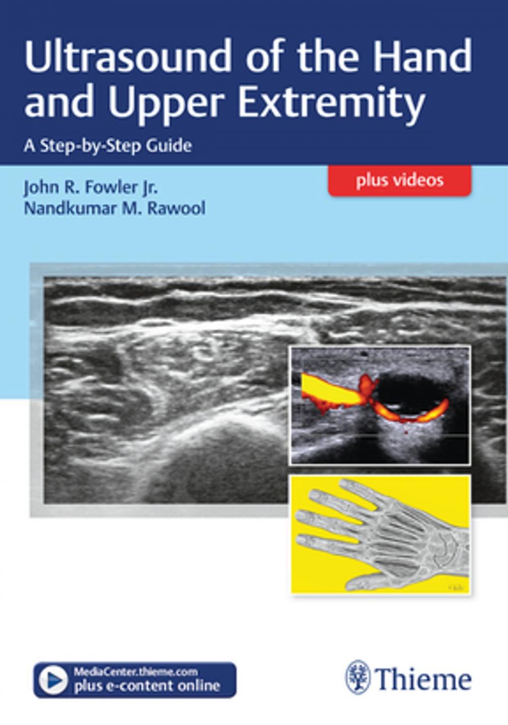 Big bigCover of Ultrasound of the Hand and Upper Extremity