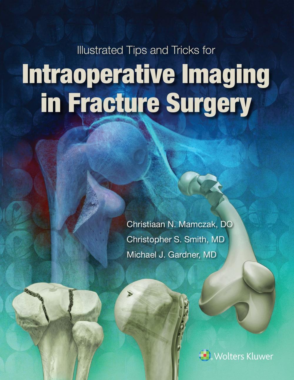 Big bigCover of Illustrated Tips and Tricks for Intraoperative Imaging in Fracture Surgery