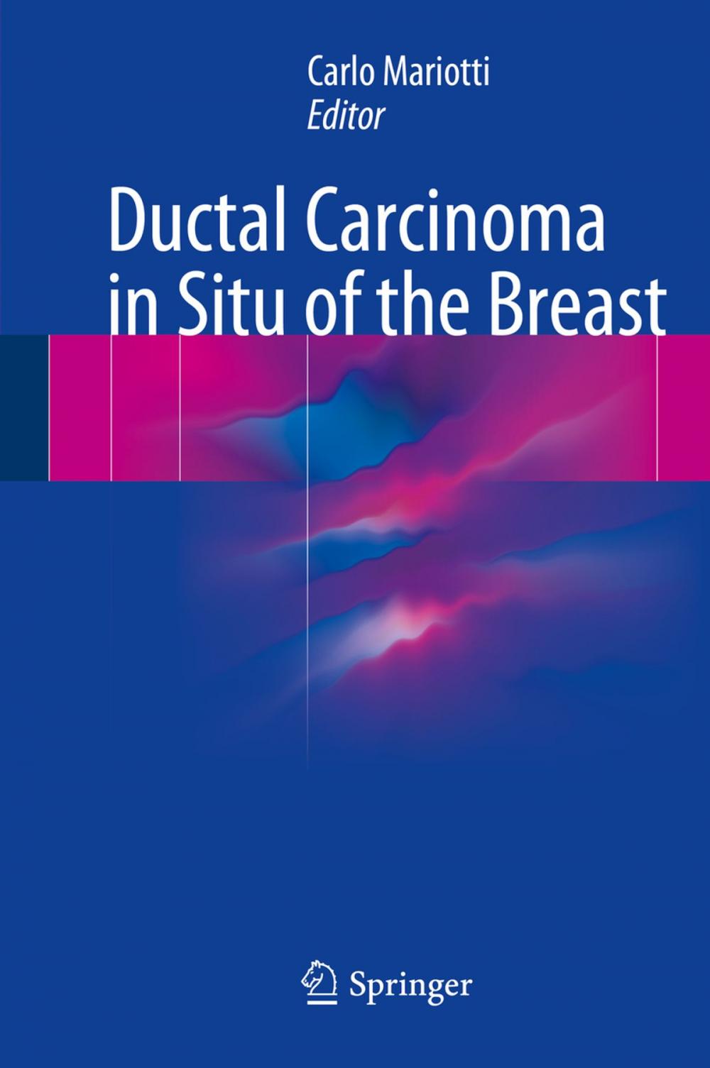 Big bigCover of Ductal Carcinoma in Situ of the Breast