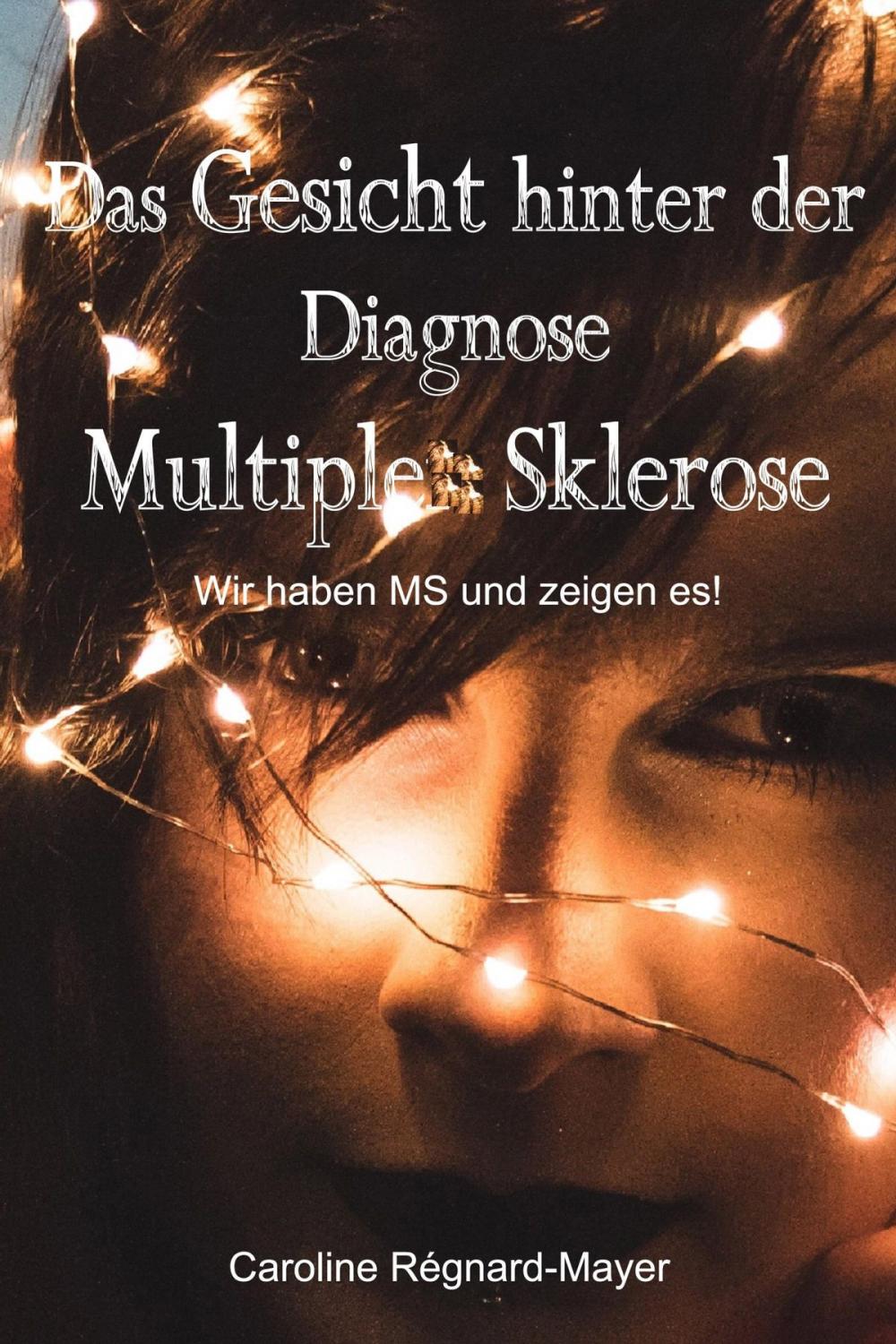 Big bigCover of Das Gesicht hinter der Diagnose Multiple Sklerose