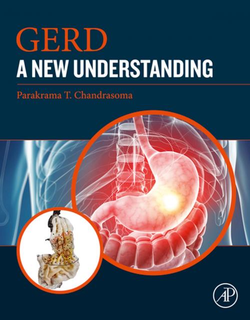 Cover of the book GERD by Parakrama T. Chandrasoma, MD, Elsevier Science