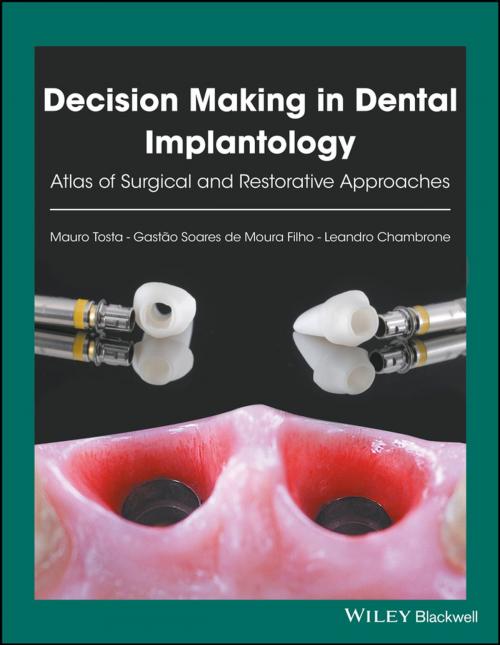 Cover of the book Decision Making in Dental Implantology by Leandro Chambrone, Gastão Soares de Moura Filho, Mauro Tosta, Wiley