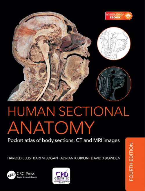 Cover of the book Human Sectional Anatomy by David J. Bowden, Bari M. Logan, Adrian Kendal Dixon, Harold Ellis, CRC Press