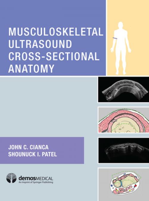 Cover of the book Musculoskeletal Ultrasound Cross-Sectional Anatomy by Shounuck I. Patel, DO, John C. Cianca, MD, Springer Publishing Company