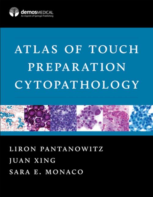 Cover of the book Atlas of Touch Preparation Cytopathology by Sara E. Monaco, MD, Liron Pantanowitz, MD, Juan Xing, MD, Springer Publishing Company