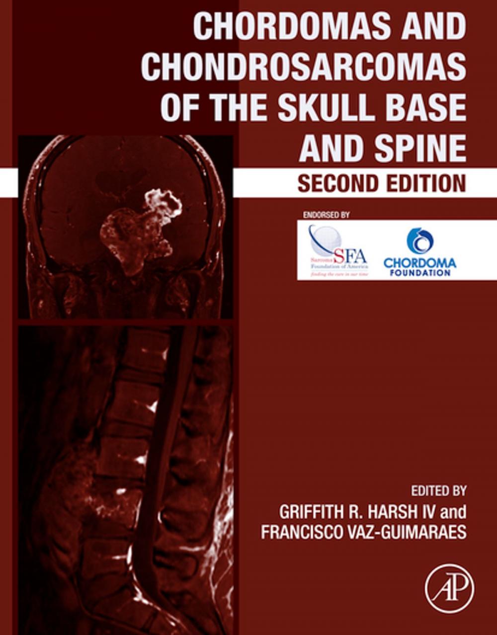 Big bigCover of Chordomas and Chondrosarcomas of the Skull Base and Spine