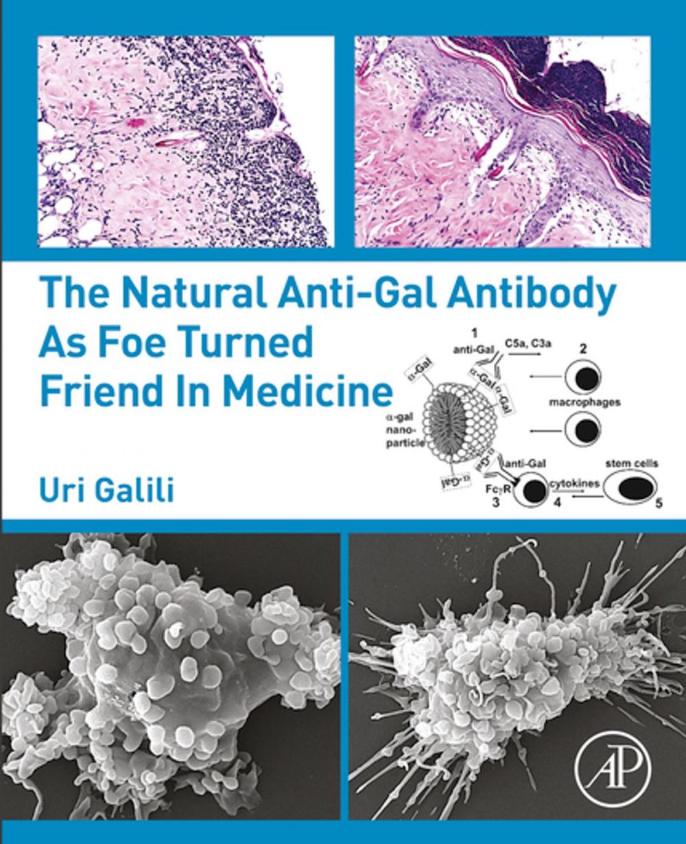 Big bigCover of The Natural Anti-Gal Antibody as Foe Turned Friend in Medicine