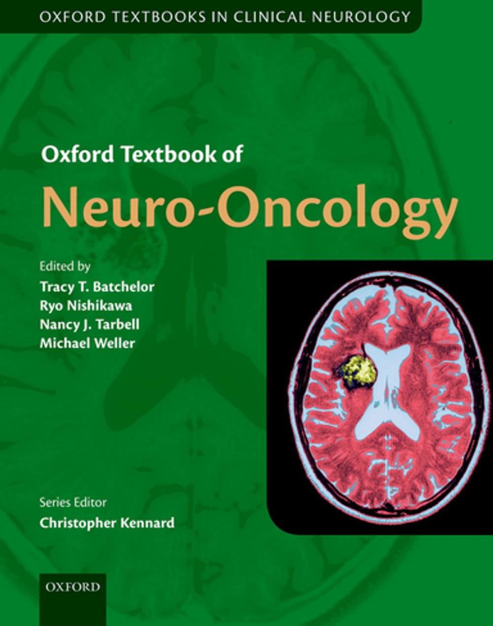 Big bigCover of Oxford Textbook of Neuro-Oncology