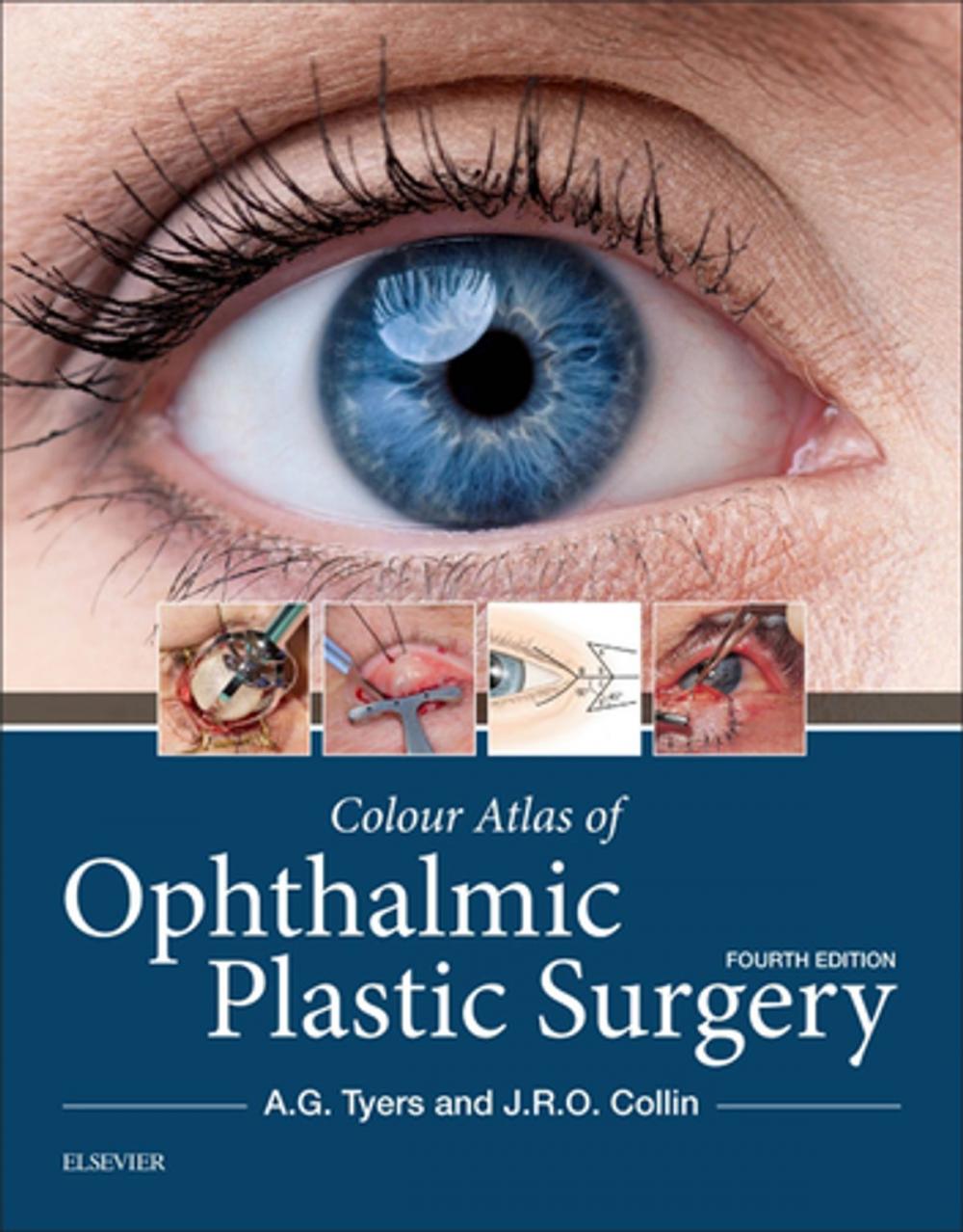 Big bigCover of Colour Atlas of Ophthalmic Plastic Surgery E-Book