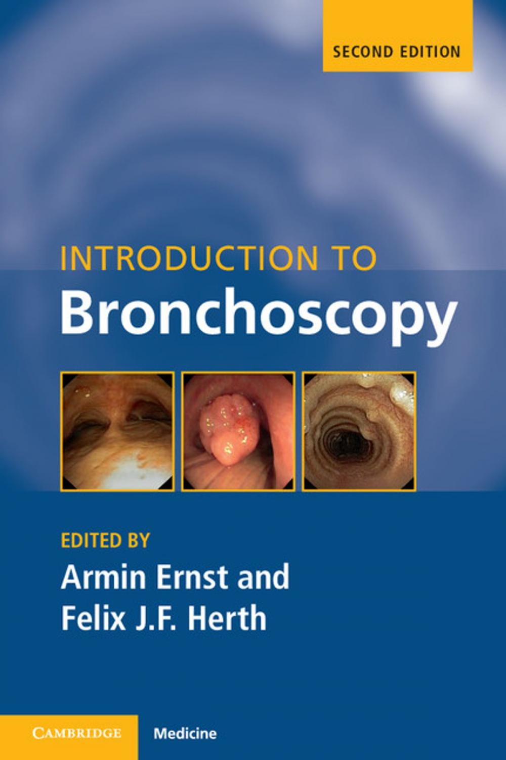 Big bigCover of Introduction to Bronchoscopy