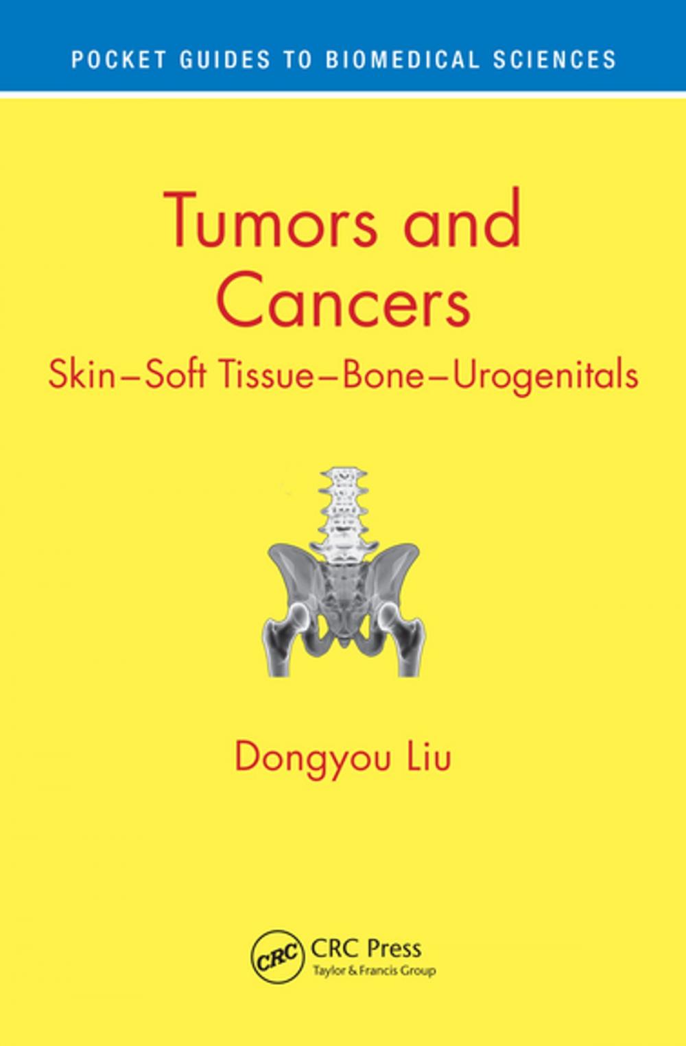 Big bigCover of Tumors and Cancers