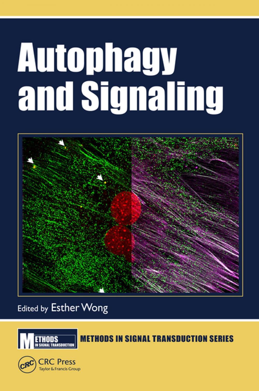 Big bigCover of Autophagy and Signaling