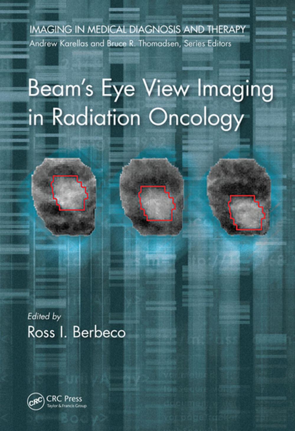 Big bigCover of Beam's Eye View Imaging in Radiation Oncology