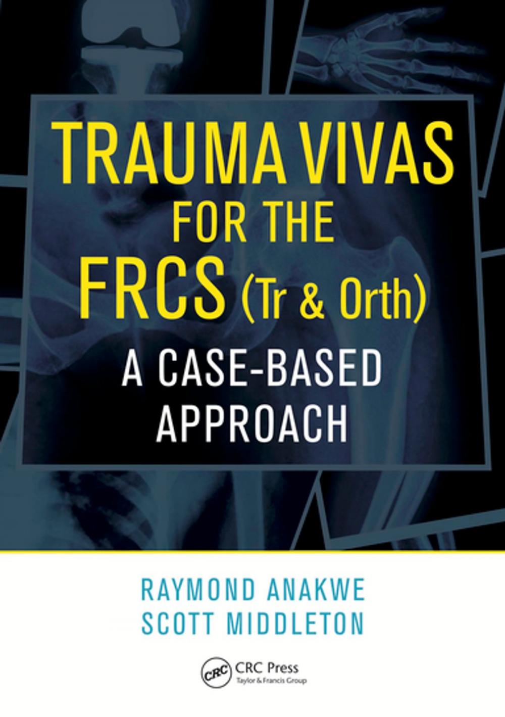 Big bigCover of Trauma Vivas for the FRCS