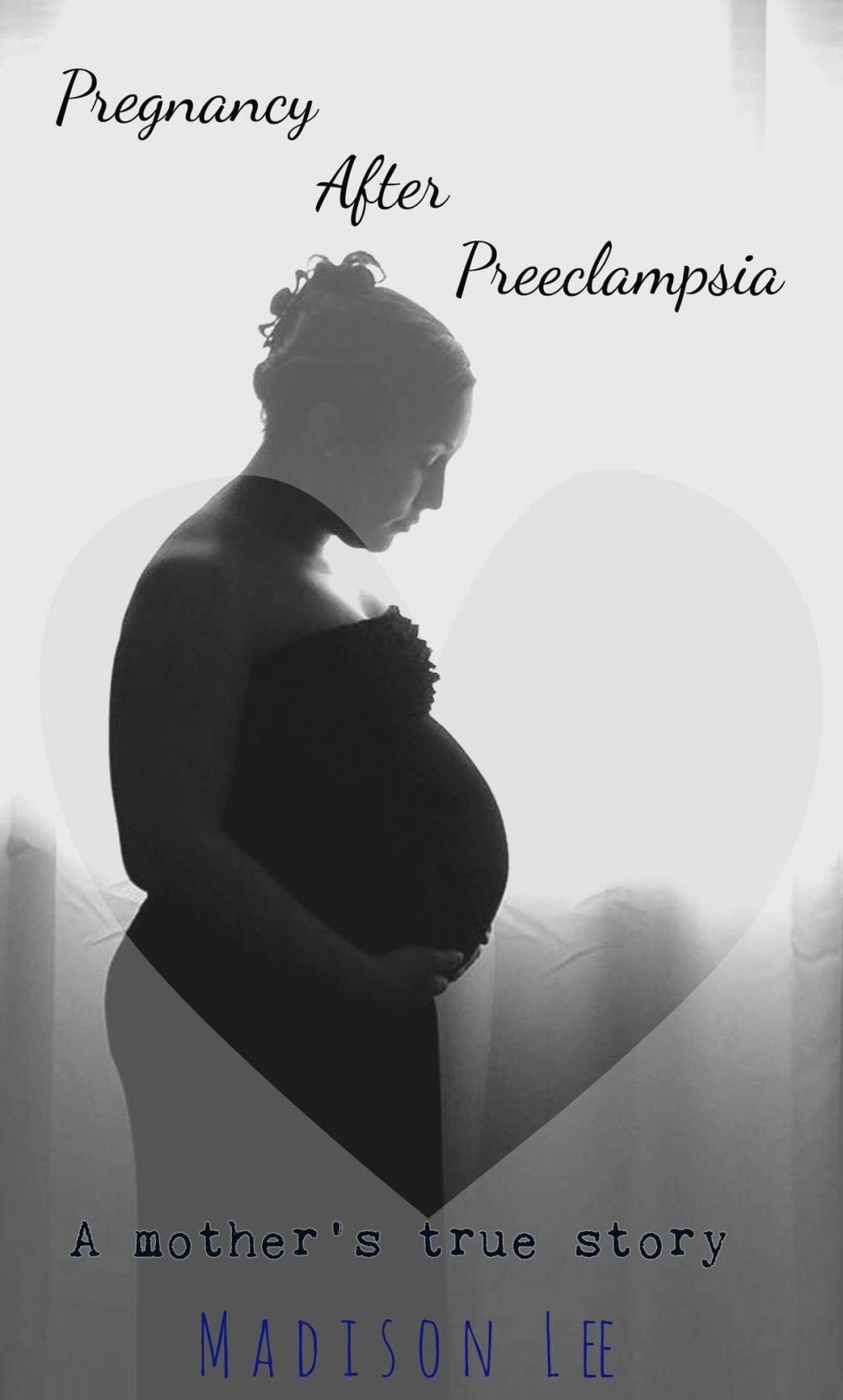 Big bigCover of Pregnancy After Preeclampsia