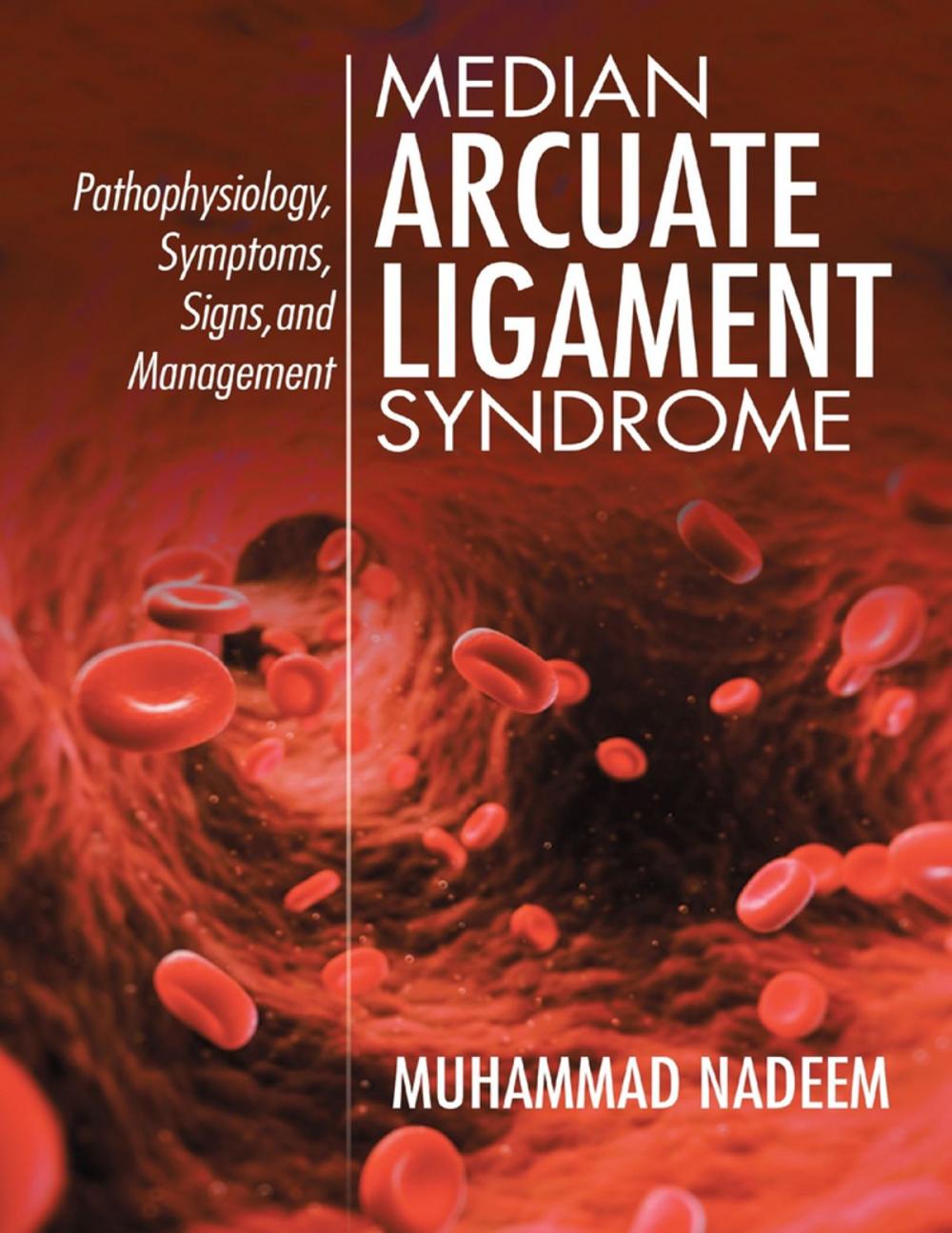 Big bigCover of Median Arcuate Ligament Syndrome: Pathophysiology, Symptoms, Signs, and Management