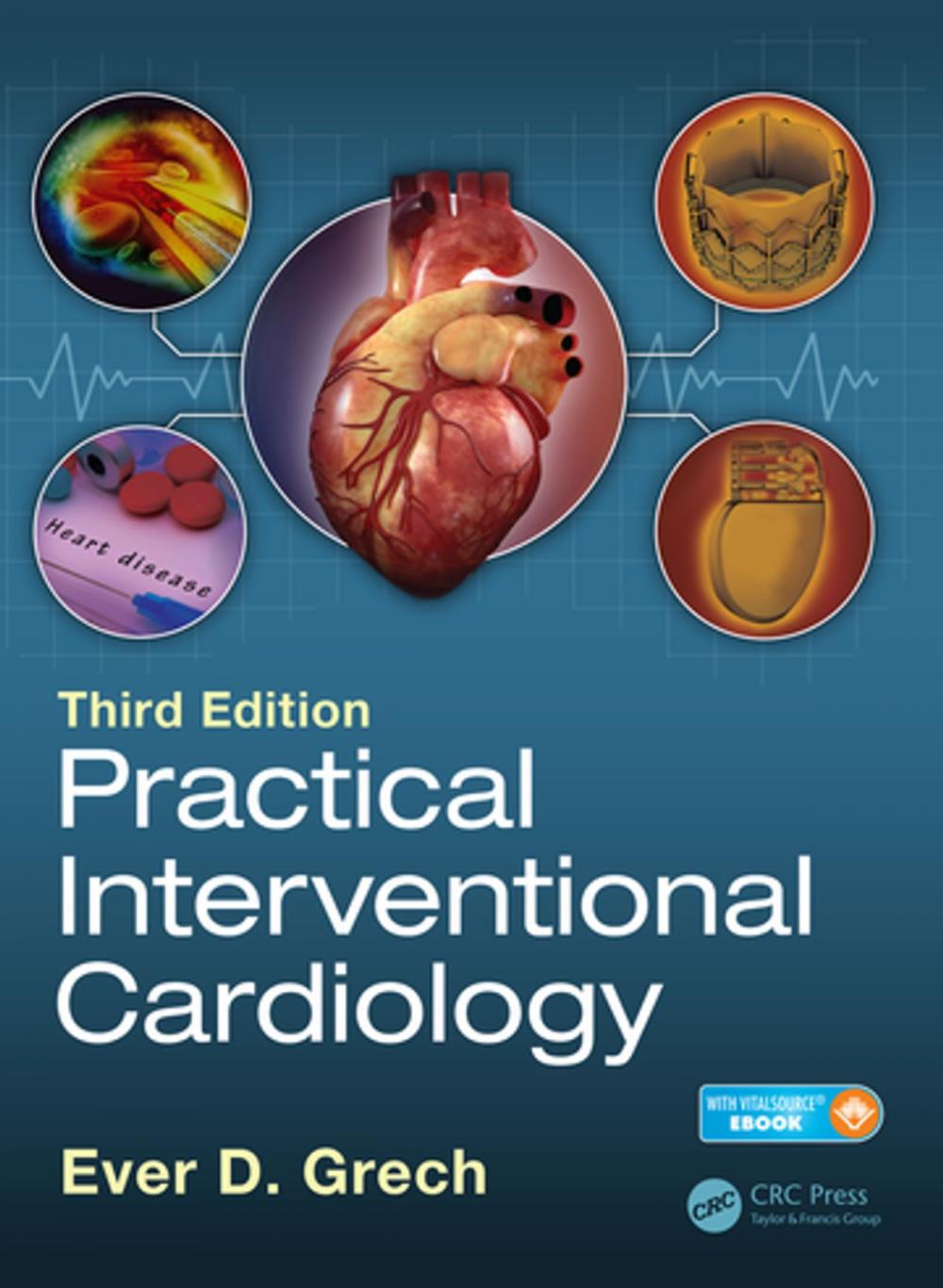 Big bigCover of Practical Interventional Cardiology