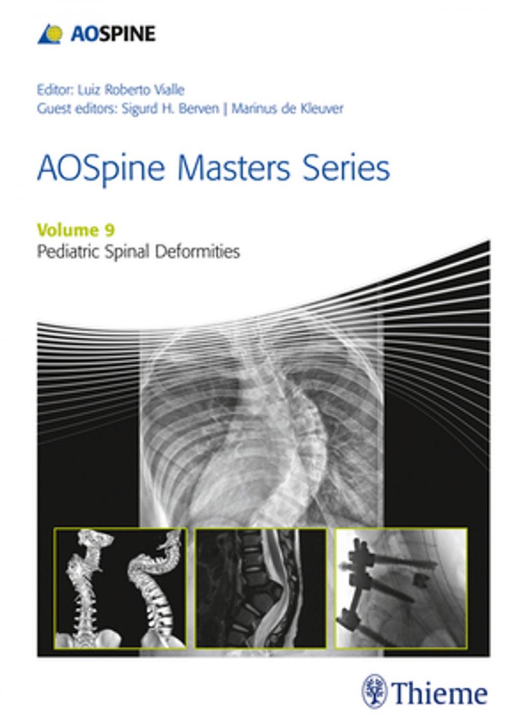 Big bigCover of AOSpine Masters Series, Volume 9: Pediatric Spinal Deformities