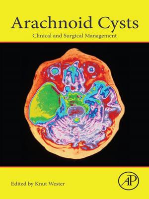 Cover of the book Arachnoid Cysts by Richard Wool, Ph.D. Materials Science & Eng. University of Utah 1974, Xiuzhi Susan Sun, Ph.D. Agr. & Bio. Engineering, University of Illinois, Urbana, IL, 1993