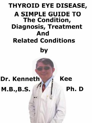 Book cover of Thyroid Eye Disease, A Simple Guide To The Condition, Diagnosis, Treatment And Related Conditions